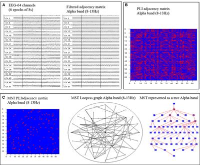 Decreased Global Network Efficiency in Young Male Smoker: An EEG Study during the Resting State